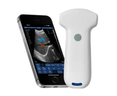 Sonos US probe